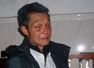 Guangzhou resident Zheng Jianyi, who died in February, in a photo taken shortly after his release in Jan. 2012. His family says he suffered torture while in jail.