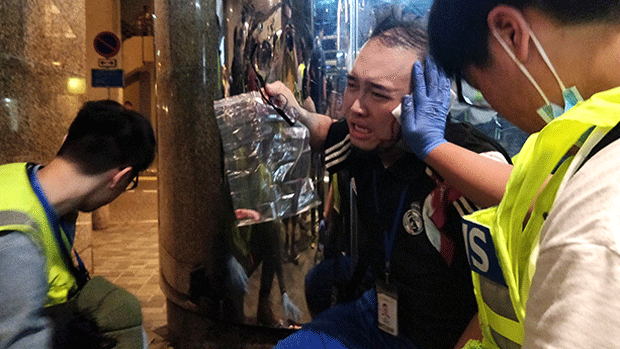 Hong Kong lawmaker Andrew Chiu reacts after being attacked during a protest in a shopping mall, Nov. 3, 2019.